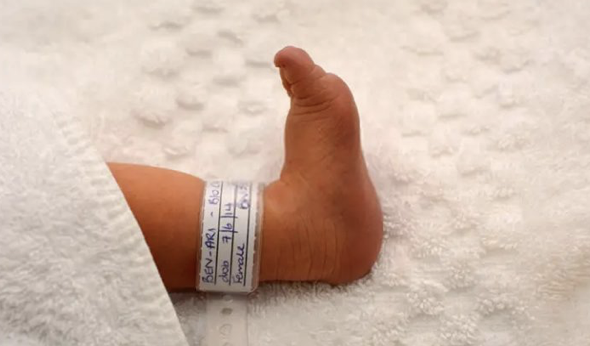 BİLEKLİK ETİKETİ ÇÖZÜMLERİ